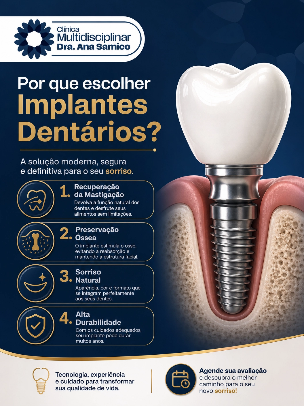 Infográfico sobre vantagens dos implantes dentários