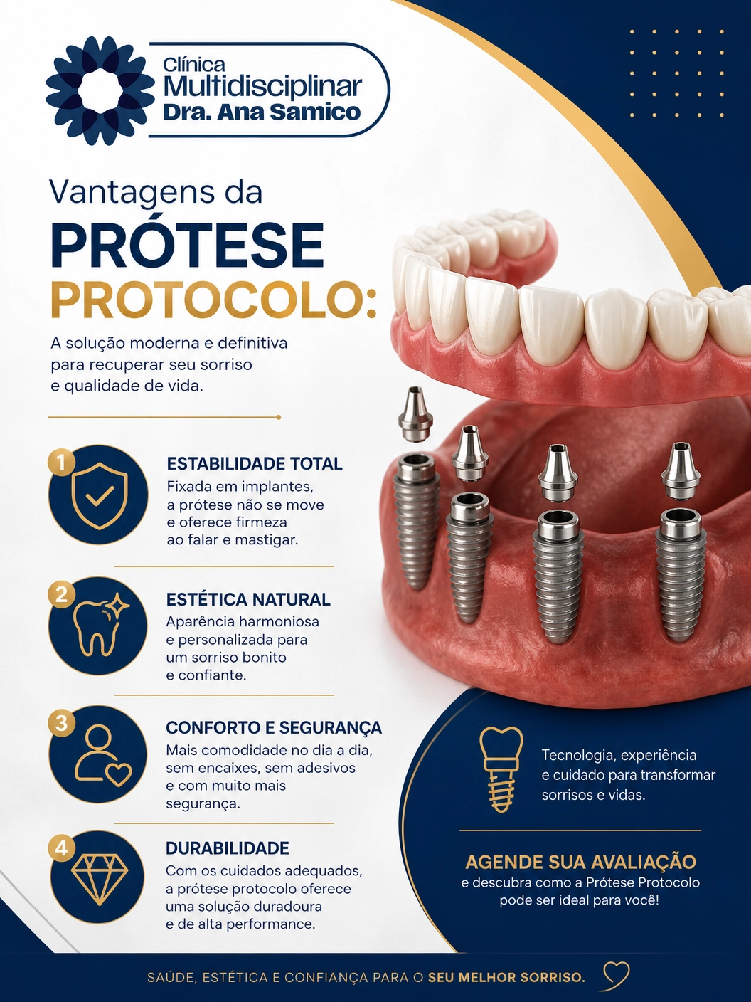 Infográfico com vantagens da prótese protocolo