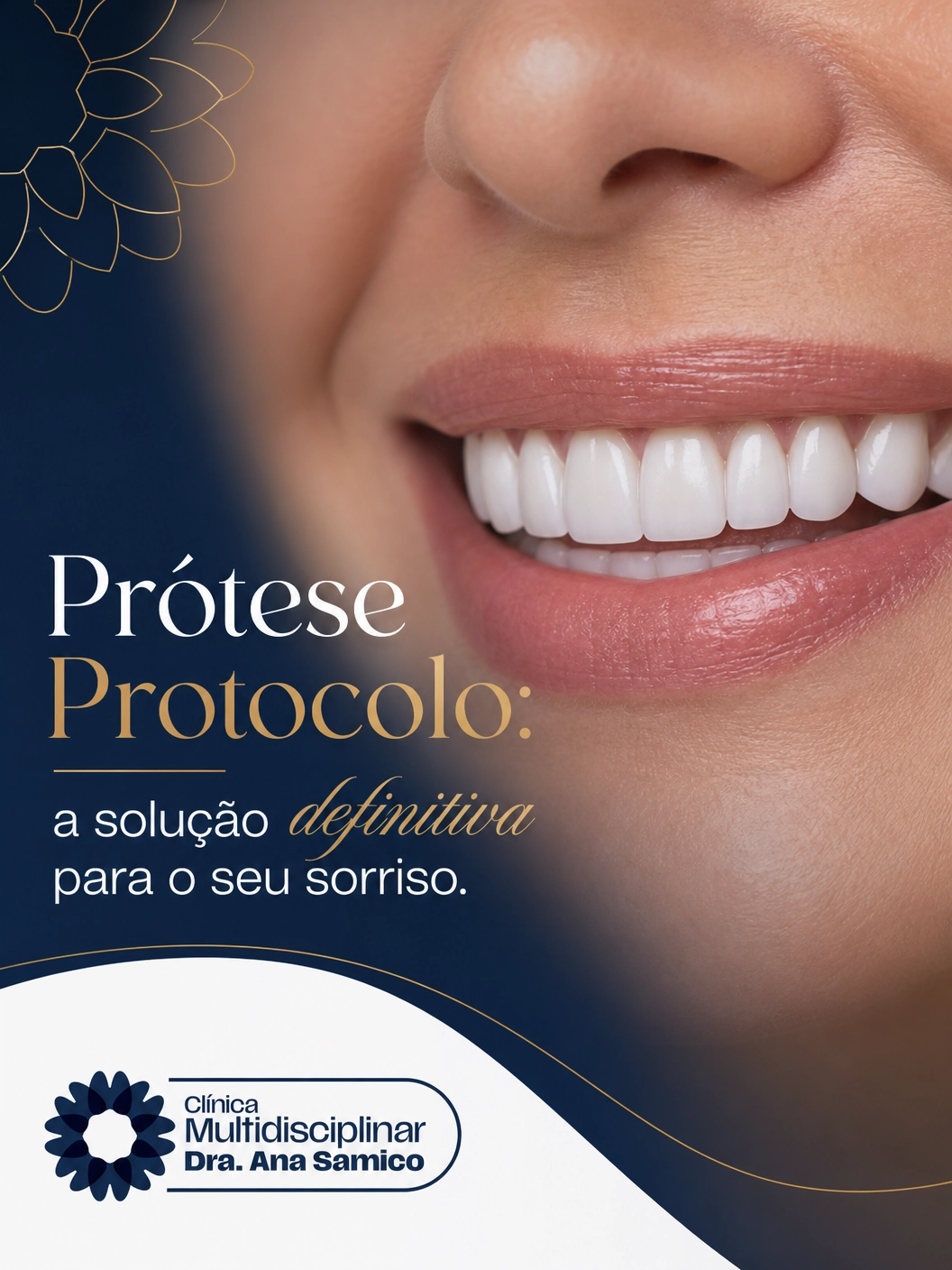 Arte sobre prótese protocolo da Clínica Dra. Ana Samico